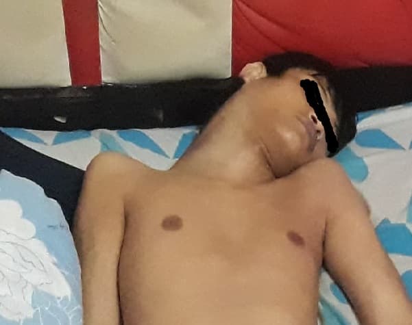 hasil_autopsi_keluar_husnam_tewas_dibunuh