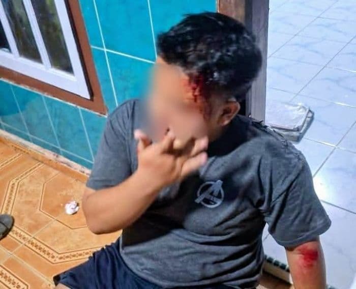 tawuran_di_simpang_dolok_batu_bara_remaja_pengendara_motor_jadi_sasaran
