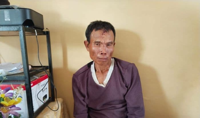curi_motor_korban_kecelakaan_pria_ini_babak_belur_dihajar_massa