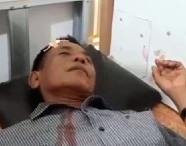 pasutri_dilempar_otk_pakai_batu_di_jalan_gelap_medang_deras_kening_korban_berdarah_