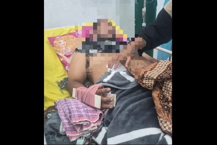 tangan_warga_sumbul_nyaris_putus_ditebas_adik_kandung_pakai_parang_korban_dirawat_di_rsud_sidikalang