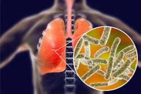penyakit_legionnaires_di_new_york_tewaskan_tiga_orang_22_terinfeksi