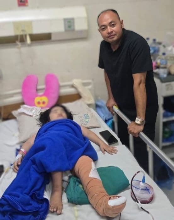 bocah_nias_selatan_korban_penganiayaan_jalani_operasi_di_rsup_h_adam_malik_medan