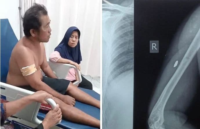 nelayan_di_asahan_diduga_jadi_korban_tembakan_peluru_nyasar_saat_melaut