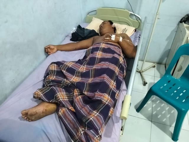 korban_selamat_kecelakaan_bus_halmahera_jalani_operasi_wajah_di_lubuk_pakam