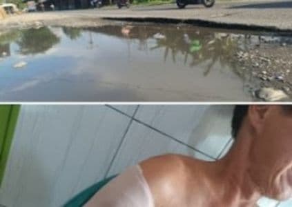 terperosok_jalan_berlubang_di_platina_i_pria_paruh_baya_alami_patah_tangan_