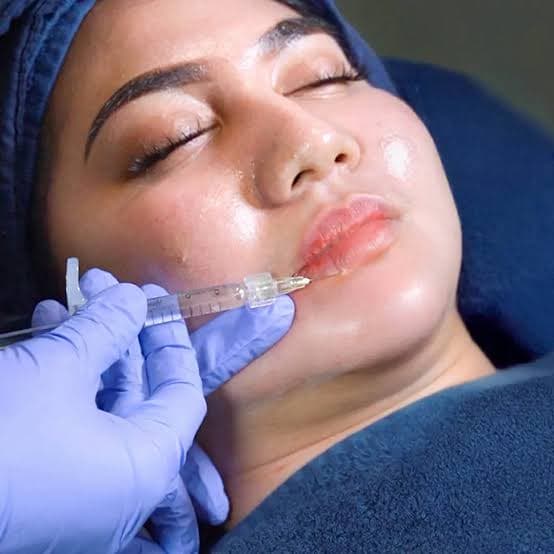 filler_tak_hanya_untuk_hidung_ini_5_area_wajah_yang_bisa_ditangani