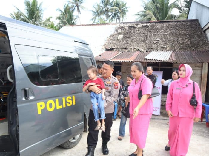 anak_penderita_stunting_di_lahusa_ditangani_kapolres_nias_selatan