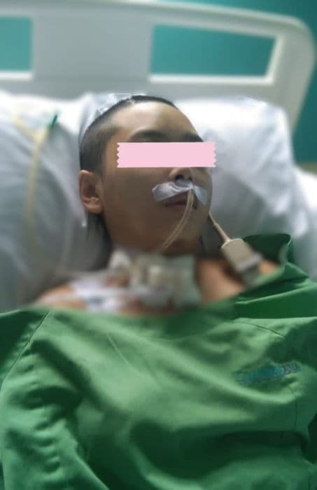 begini_kondisi_perempuan_asal_kisaran_usai_ditabrak_bripda_vp_di_merak_jingga