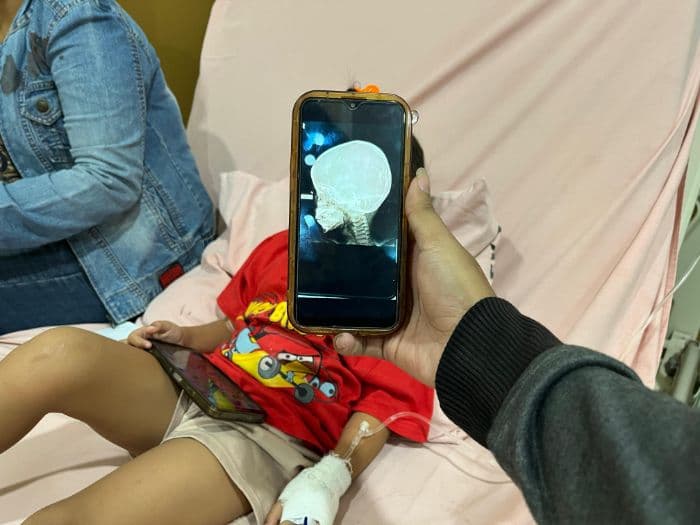 bocah_4_tahun_korban_peluru_nyasar_di_medan_jalani_operasi_8_jam_di_rsup_adam_malik