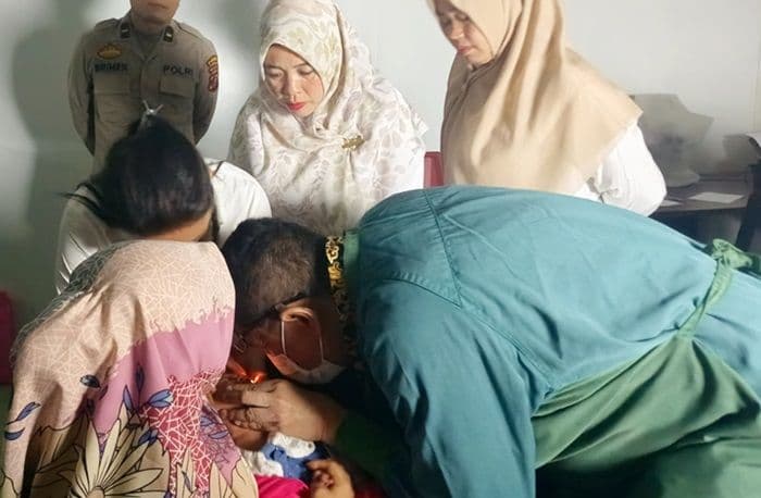 dinkes_sergai_dan_rsud_sultan_sulaiman_tangani_balita_hidrosefalus