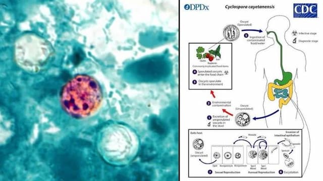 siklosporiasis_merebak_di_31_negara_bagian_as_kenali_gejala_cara_penularan_dan_fakta_yang_jarang_diketahui