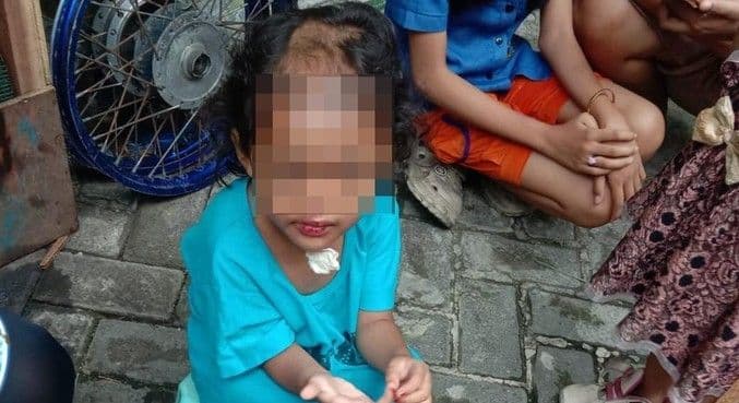 balita_empat_tahun_dianiaya_pamanbibi_disekap_dan_dibotaki_