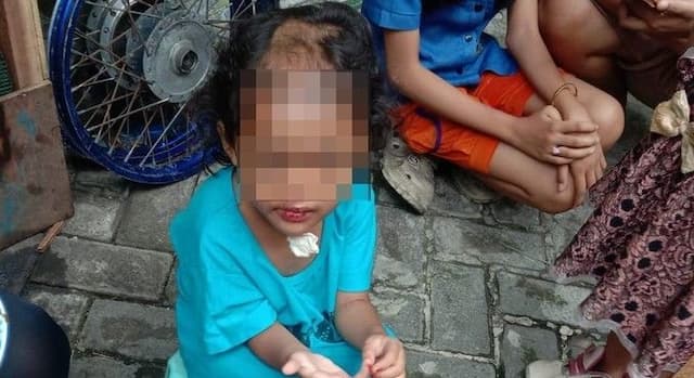 balita_empat_tahun_dianiaya_pamanbibi_disekap_dan_dibotaki_
