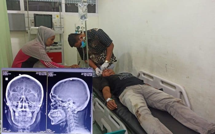 karyawan_ptpn_iv_diduga_dianiaya_dan_ditembak_senapan_angin_di_kebun_sarang_giting