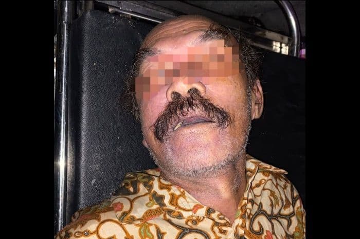 korban_tabrak_lari_di_pematangsiantar_tewas_identitas_masih_misterius