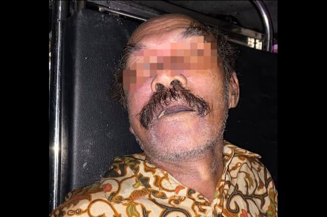 korban_tabrak_lari_di_pematangsiantar_tewas_identitas_masih_misterius