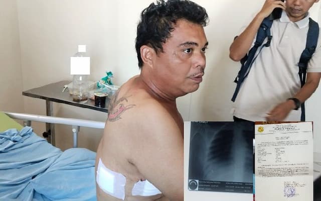 satpam_korban_begal_di_percut_sei_tuan_sebut_pelaku_diduga_anak_smp_dan_sma