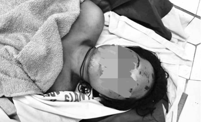polisi_tahan_dua_tersangka_kasus_penganiayaan_maut_di_siantar_empat_diburu