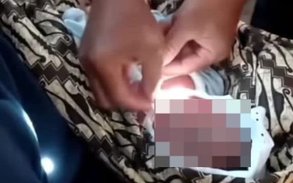 kepala_bayi_pasien_putus_saat_persalinan_di_puskesmas_pinangsori_tapteng_