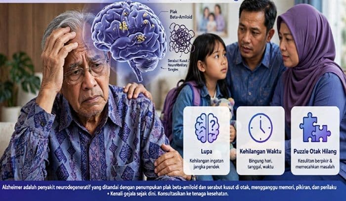 penyakit_alzheimer_belum_ada_obatnya_yang_digerogoti_adalah_otak_