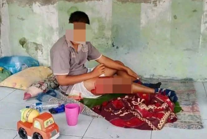 remaja_di_deli_serdang_diduga_jadi_korban_perundungan_dan_penganiayaan