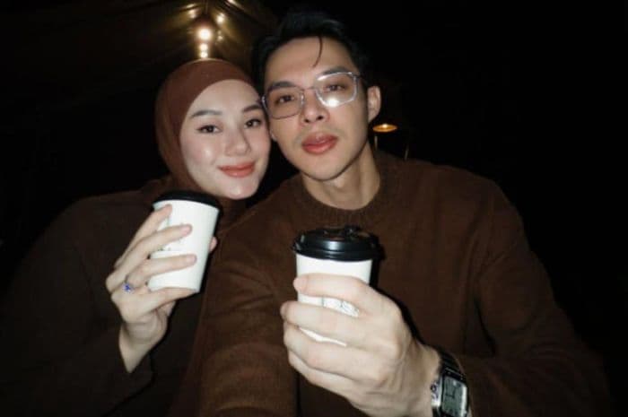 rey_mbayang_mendadak_cukur_rambut_jadi_botak_ternyata_idap_penyakit_serius