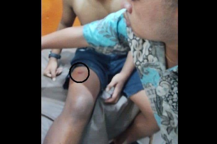 remaja_16_tahun_jadi_korban_bacokan_saat_tawuran_di_medan_tembung_dikejar_komplotan_tak_dikenal