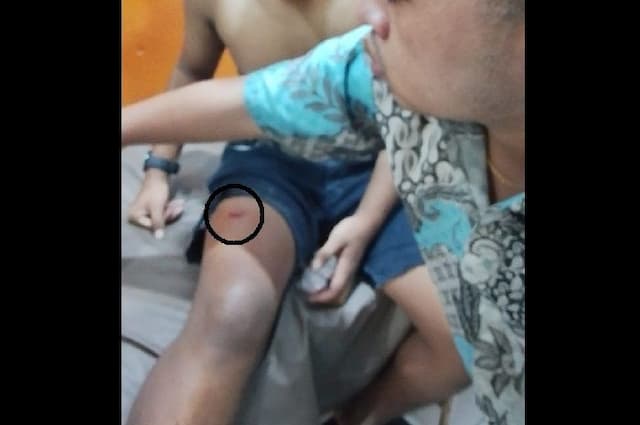 remaja_16_tahun_jadi_korban_bacokan_saat_tawuran_di_medan_tembung_dikejar_komplotan_tak_dikenal