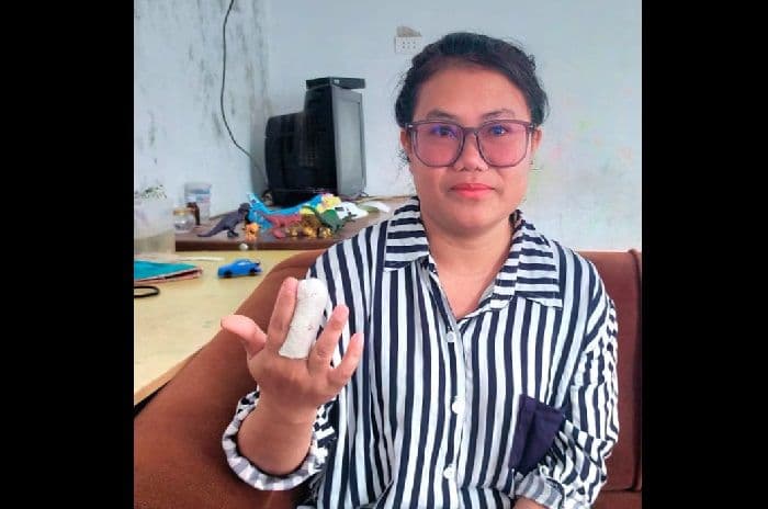 suami_korban_penganiayaan_di_sidikalang_laporkan_penyidik_ke_propam_polda_sumut