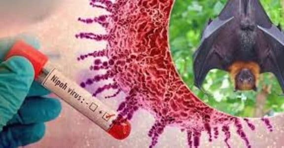 belum_ada_vaksin_virus_nipah_dinilai_sangat_mematikan_hingga_75_persen