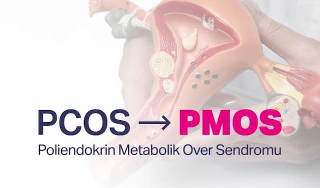 alasan_istilah_pcos_berubah_menjadi_pmos