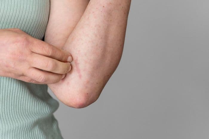 hpv_bisa_menular_lewat_kontak_kulit_pria_dan_wanita_samasama_berisiko