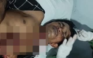 warga_medan_deli_bersimbah_darah_dibacok_pelaku_kabur_