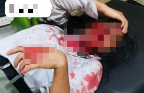 siswi_diduga_disayat_temannya_di_sekolah_taman_siswa_binjai_pelakunya_sudah_ditangkap