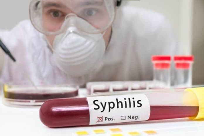 5_obat_untuk_mengobati_sipilis_yang_ampuh_dan_dijual_di_pasaran