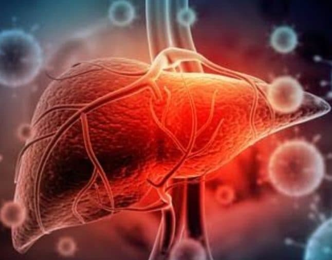 74_persen_pasien_hepatitis_misterius_positif_adenovirus