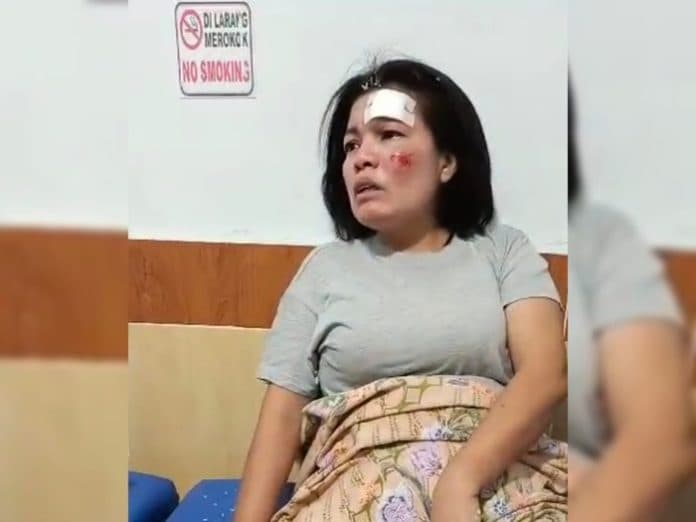 asn_kodam_ibb_terluka_usai_dijambret_pengendara_sepeda_motor_di_jalan_patriot_medan