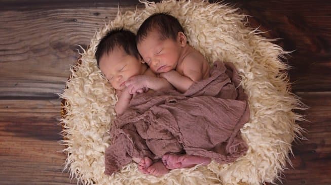 bayi_kembar_siam_hasan_dan_husein_masih_sulit_dapat_pendonor_asi