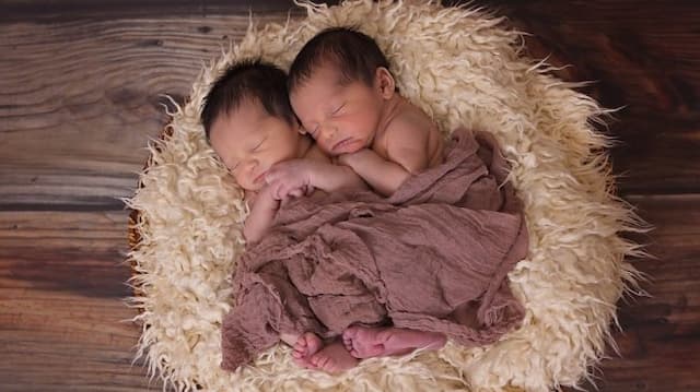 bayi_kembar_siam_hasan_dan_husein_masih_sulit_dapat_pendonor_asi