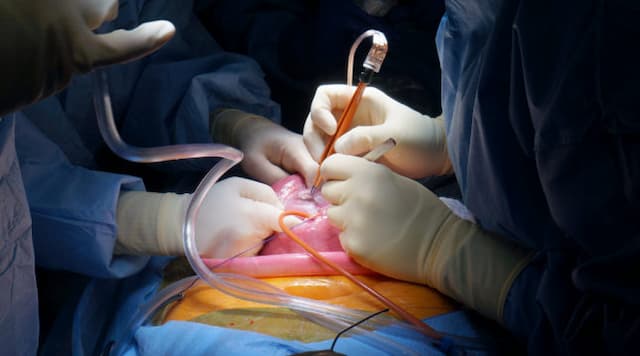 beberapa_kondisi_medis_yang_bisa_ditangani_lewat_fetal_surgery