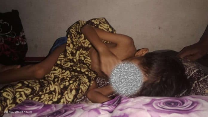 bocah_5_tahun_penderita_tumor_ganas_di_palas_sangat_butuh_perhatian_pemkab