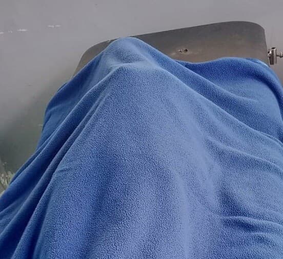 bocah_korban_gigitan_anjing_di_dairi_meninggal_dunia