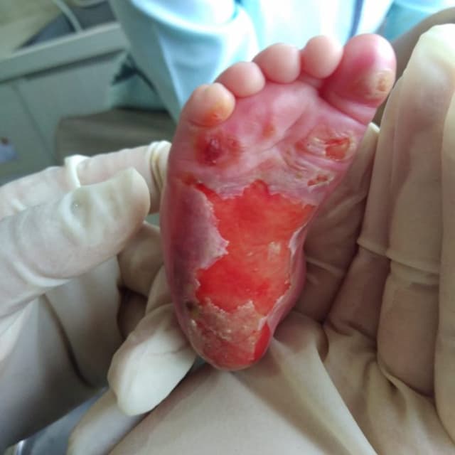 dugaan_malapraktik_kaki_bayi_polda_sumut_sudah_periksa_pelapor