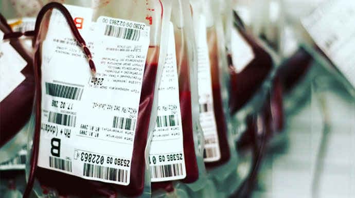 duh_514_kantong_darah_pmi_terinfeksi_hiv_hingga_sipilis