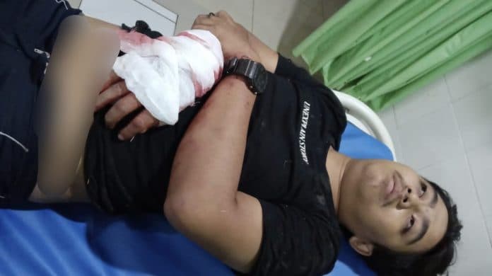 genk_motor_tebas_kaki_dan_tangan_warga_medan_labuhan