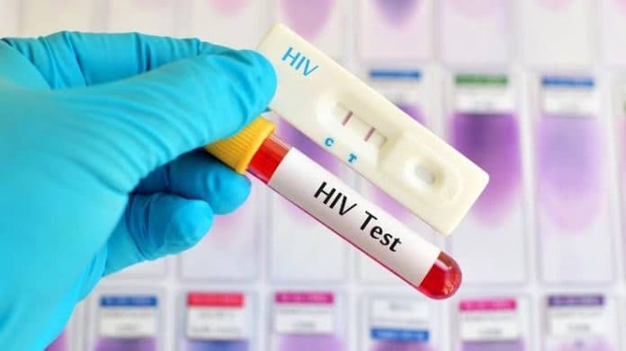 kelompok_pria_dominasi_kasus_hiv_di_simalungun