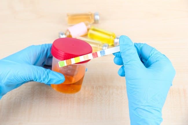 ketua_gmki_tes_urine_harus_digalakkan_di_siantar
