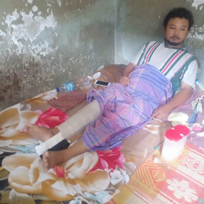kis_diblokir_ngurus_bpjs_nunggu_14_hari_korban_laka_patah_tulang_pasrah_terkapar_di_rumah