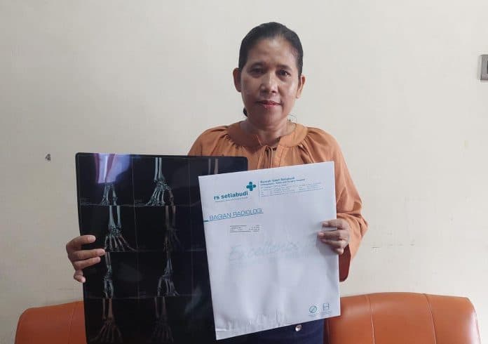 korban_tabrak_lari_pekerja_penyalur_art_pulih_berkat_perlindungan_bpjs_ketenagakerjaan